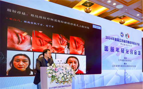 1732867363962357.png 图片2.png